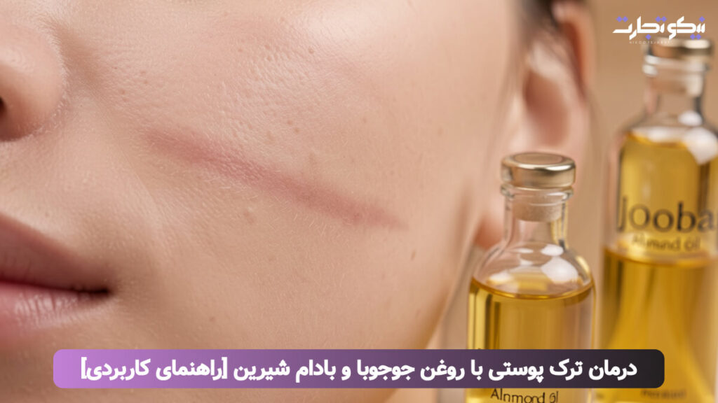 درمان ترک پوستی با روغن جوجوبا و بادام شیرین [راهنمای کاربردی] (1)