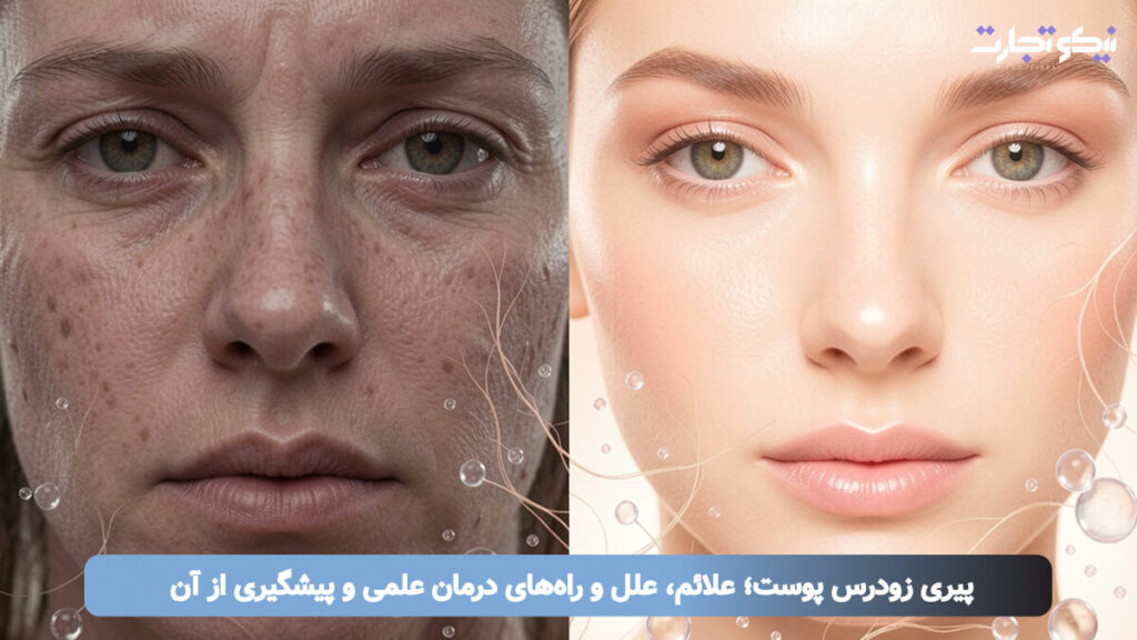 پیری زودرس پوست
