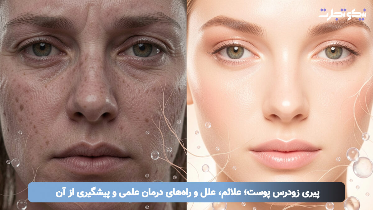 پیری زودرس پوست