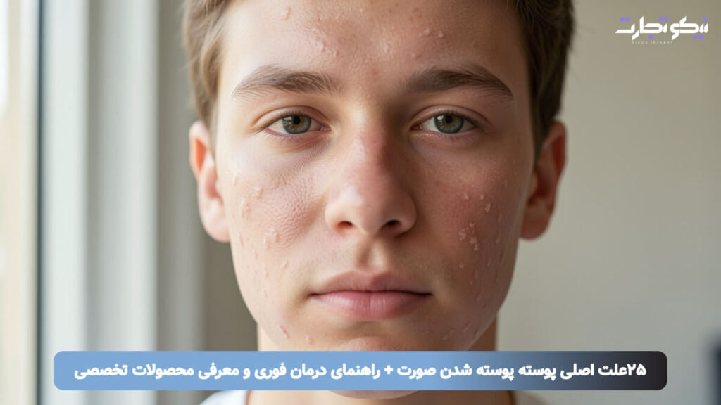 ۲۵علت اصلی پوسته پوسته شدن صورت + راهنمای درمان فوری و معرفی محصولات تخصصی