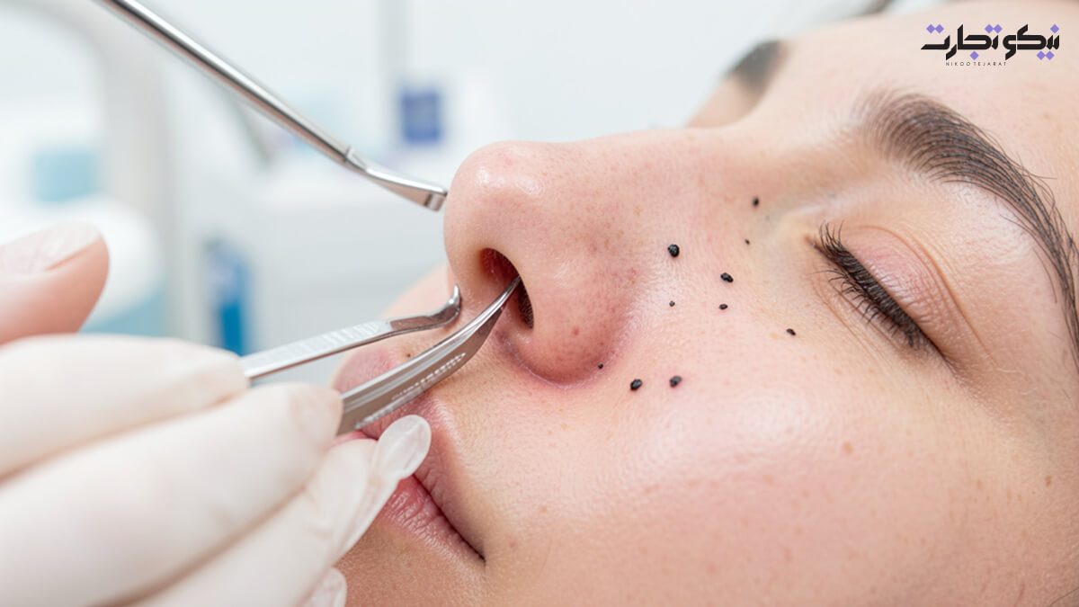 روش ۱۱ تخلیه دستی و تخصصی (Manual Extraction)
