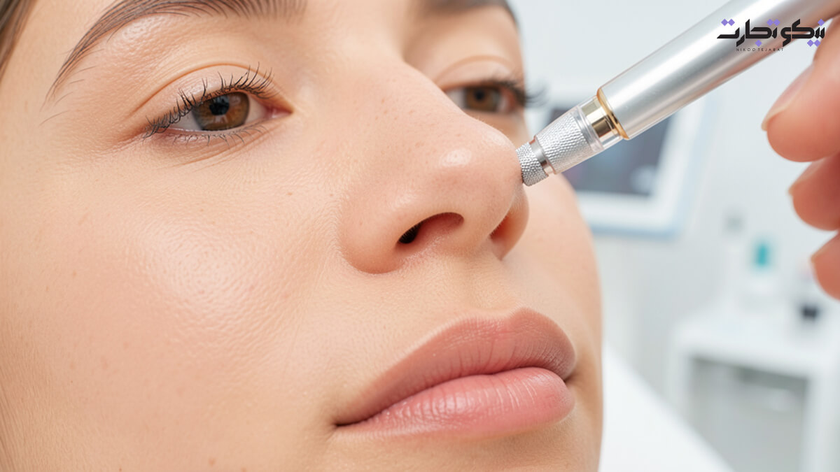 روش ۱۲ میکرودرم ابریژن (Microdermabrasion)