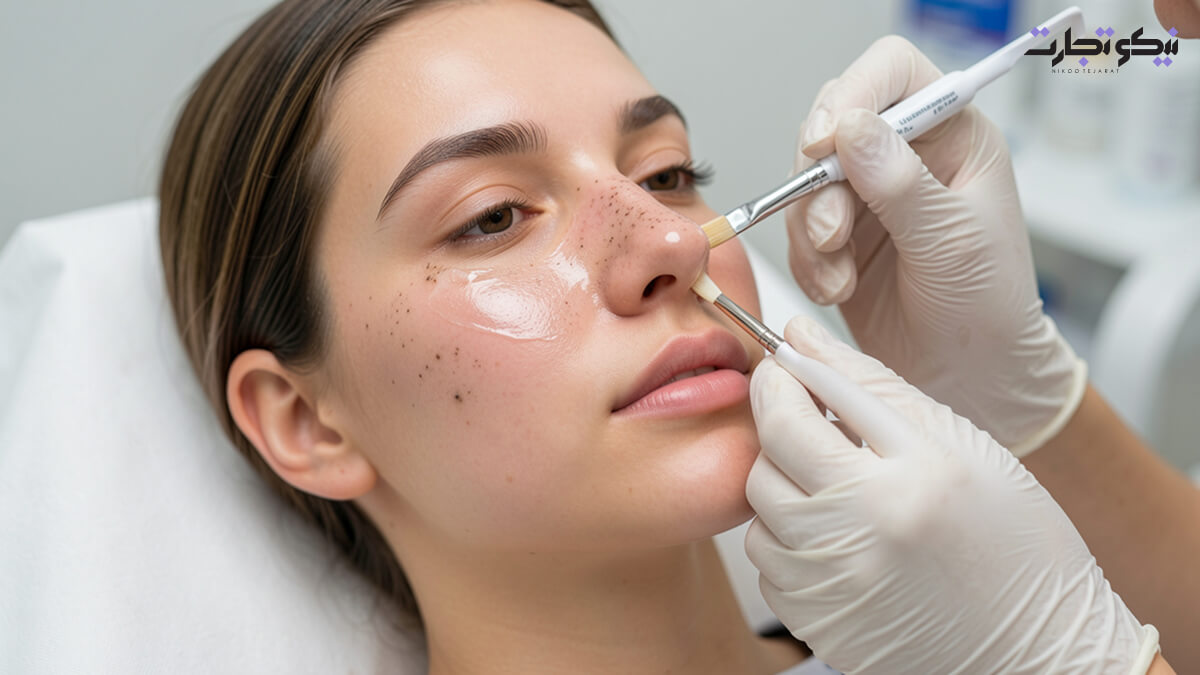 روش ۱۴ لایه_برداری شیمیایی کلینیکی (Chemical Peels)