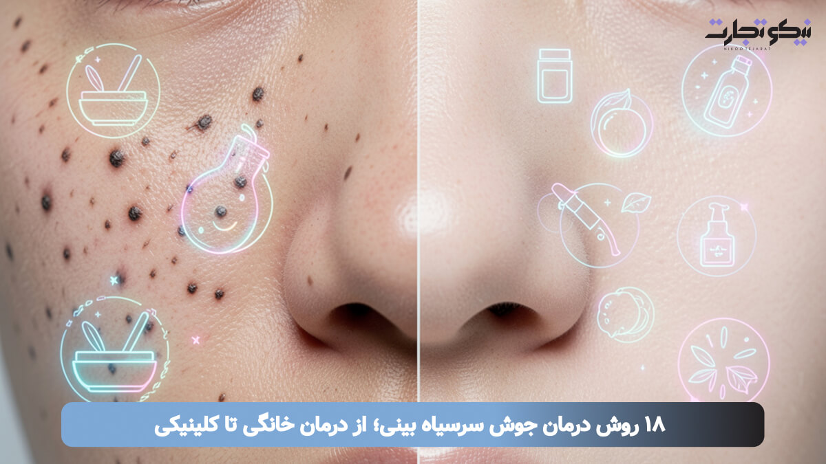 ۱۸ روش درمان جوش سرسیاه بینی؛ از درمان خانگی تا کلینیکی